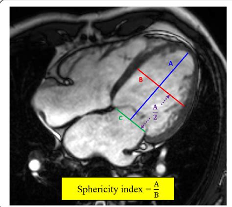 sphericity index